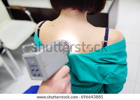 The doctor examines neoplasms or moles on the patient's skin - a young girl using a special apparatus for dermatoscopy - a dermoscope. Prevention of melanoma and skin cancer.