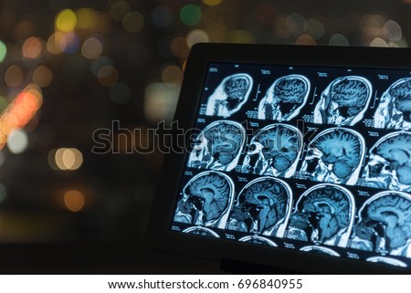 magnetic resonance image, mri scan of the brain on tablet screen computer. Royalty-Free Stock Photo #696840955