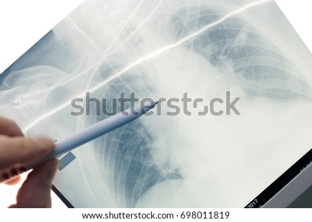 Doctor inspecting patient's x-ray film.