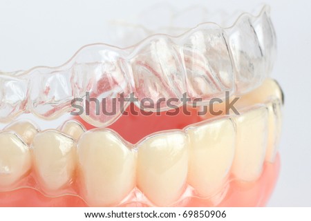 Denture with braces Royalty-Free Stock Photo #69850906
