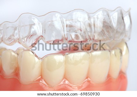 Denture with braces Royalty-Free Stock Photo #69850930
