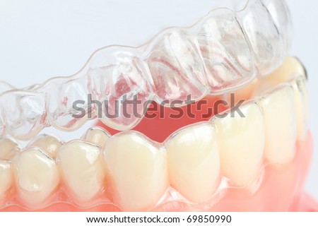 Denture with braces Royalty-Free Stock Photo #69850990
