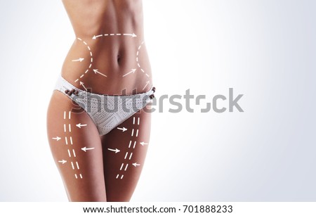Female body with the drawing arrows on it. Fat lose, liposuction and cellulite removal concept. Royalty-Free Stock Photo #701888233