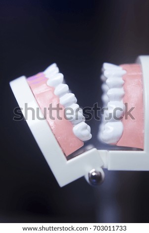 Dental teeth orthodontic dentistry teachng model with gums, tooth enamel, plaque, roots and metal implants.