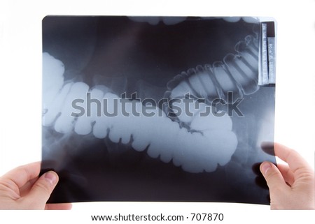 A doctor examining an abdominal x-ray