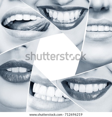 Collage of healthy smile in diaphragm shape.