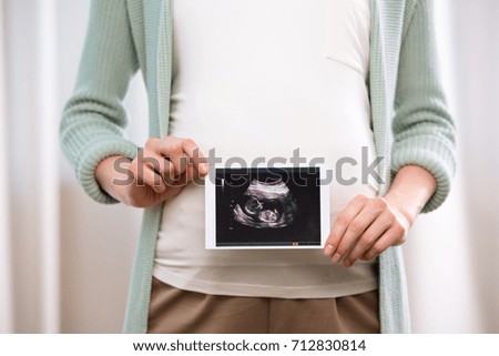 Partial view of pregnant woman holding ultrasound scan of baby in hands
