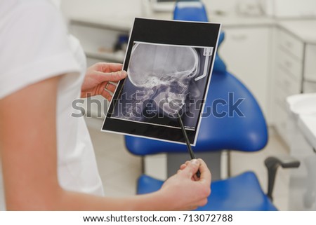 The female dentist holds an X-ray photo of a human skull from a profile in the dental office