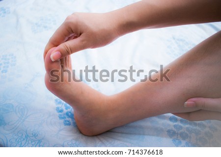 Woman has numbness on her right foot. Cramp, Spasm, Twinge, Sprain