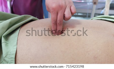 Para Umbilical Hernia.  Central abdominal swelling in adult around the umbilicus due to defect in the layer of abdominal wall.Cough impulse positive.
 Royalty-Free Stock Photo #715423198