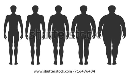Body mass index vector illustration from underweight to extremely obese. Man silhouettes with different obesity degrees. Male body with different weight. Royalty-Free Stock Photo #716496484
