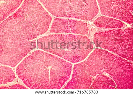 Light micrograph of a liver showing hepatic lobules and portal areas Royalty-Free Stock Photo #716785783