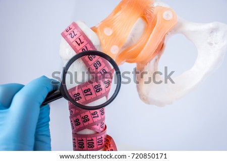 Diagnosis of bone density and presence of osteoporosis photo idea. Doctor examines through magnifying indicators measuring tape wrapped around femur,  diagnosing densities of bone and osteoporosis