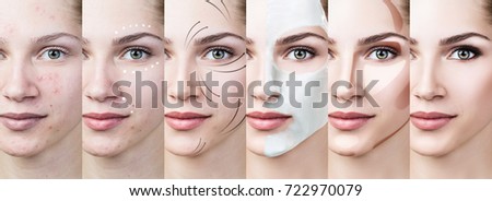 Woman step by step improves her skin condition. Royalty-Free Stock Photo #722970079