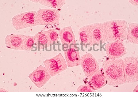 Root tip of Onion and Mitosis cell in the Root tip of Onion under a microscope. Royalty-Free Stock Photo #726053146