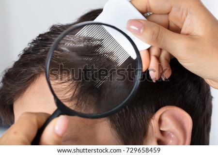 Close-up Of A Dermatologist's Hand Checking Patient's Hair With Magnifying Glass