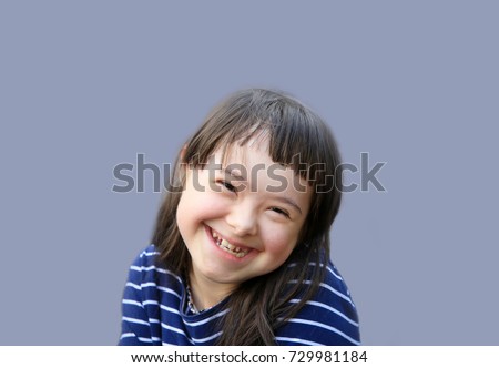 Cute smiling down syndrome girl on the blue background Royalty-Free Stock Photo #729981184