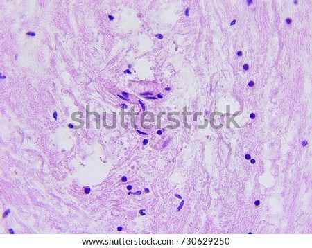 Brain tissue microscopic photography
