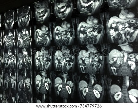 MRI scan images