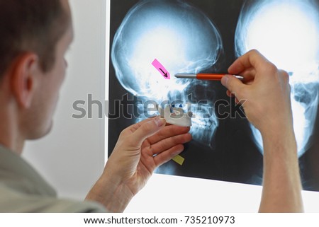 Professional with model of lower jaw watching images of skull  at x-ray film viewer. Diagnosis,treatment planning Royalty-Free Stock Photo #735210973