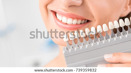 Beautiful smile and white teeth of a young woman. Matching the shades of the implants or the process of teeth whitening. Royalty-Free Stock Photo #739359832