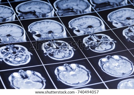 Film with pictures of the brain. MRI