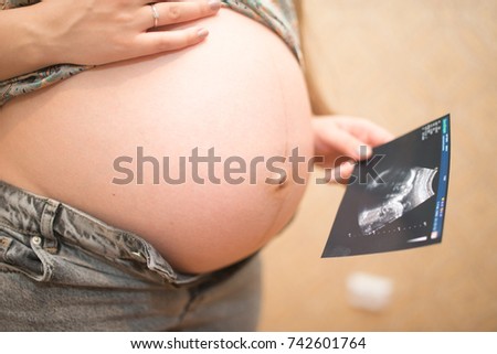 The pregnant girl pushed back her t-shirt to show her big belly, and in her other hand a photo of an ultrasonic study