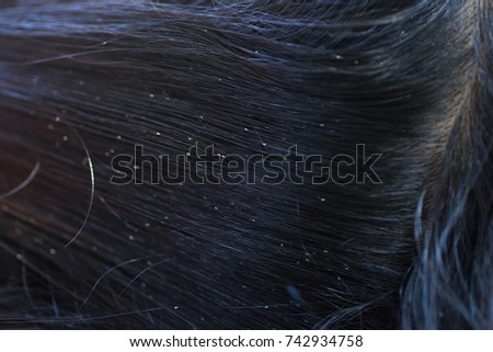 Close up black hair with lice eggs (Head lice nit)