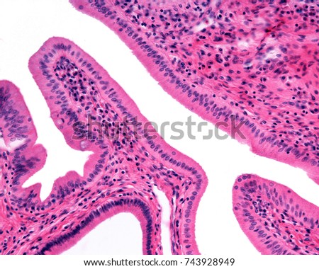 High magnification micrograph showing the simple columnar epithelium lining the common bile duct at the ampulla of Vater.

 Royalty-Free Stock Photo #743928949