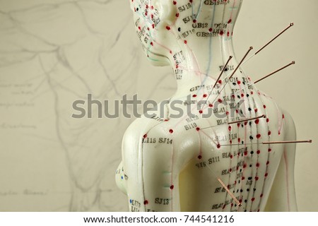 female acupuncture model with needles in the shoulder Royalty-Free Stock Photo #744541216