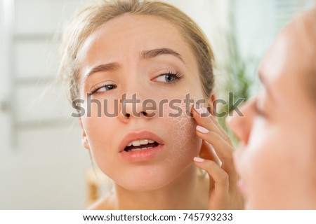 Young beautiful woman touching skin in bathroom. Unhappy girl standing in towel, looking in the mirror, checking dry irritated skin. Morning skincare routine.   Royalty-Free Stock Photo #745793233