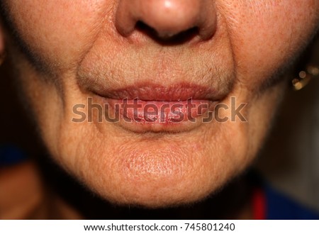 Sunken cheeks. Nasolabial folds on face. Wrinkles Royalty-Free Stock Photo #745801240