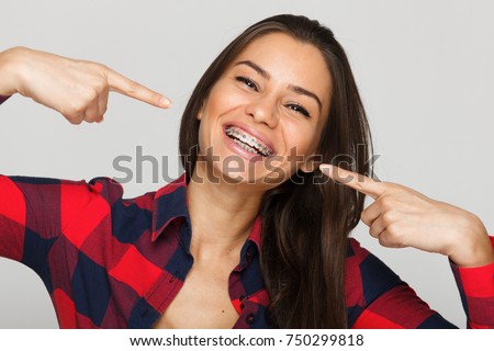 Face of a young woman with braces on her teeth Royalty-Free Stock Photo #750299818
