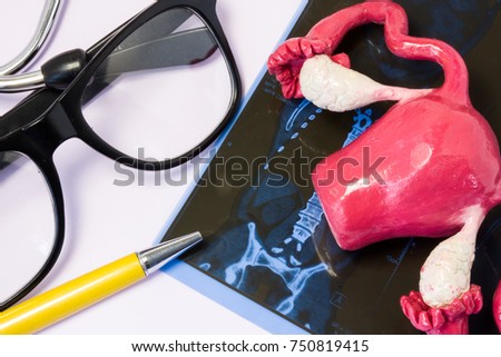 MRI (magnetic resonance imaging) of uterus and ovaries. Model of uterus lies next to diagnostic image MRI or CT abdomen and pelvic near doctor pen and glasses. Diagnosis of uterus diseases using MRI Royalty-Free Stock Photo #750819415