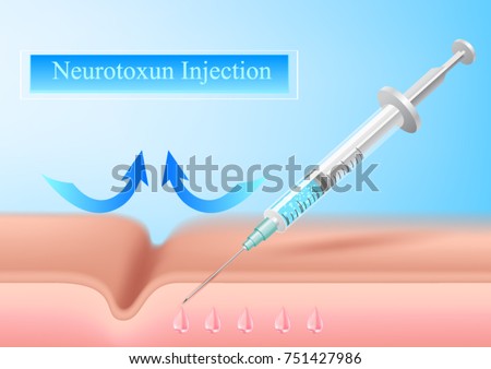neurotoxin injection.Vector Illustrated  cosmetology Botox injections. Infographics  of medical cosmetic procedures for face skin. Royalty-Free Stock Photo #751427986