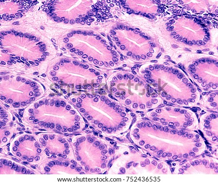 Cross section of gastric pits lined by the surface epithelium of the stomach, formed by mucous-secreting cells called foveolar cells Royalty-Free Stock Photo #752436535