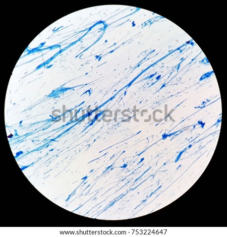 Smear of Acid-Fast bacilli (AFB) stained under 100X light microscope and no AFB bacteria observed on this smear.