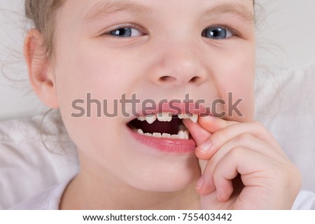 a little girl wobbles a milk tooth, with two fingers Royalty-Free Stock Photo #755403442