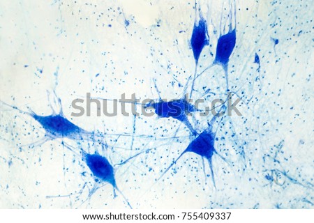 Light micrograph of human brain tissue showing neurons and glial cells Royalty-Free Stock Photo #755409337