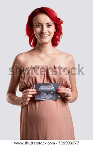A pregnant woman with red hair is holding a picture of an ultra sound study. White background.