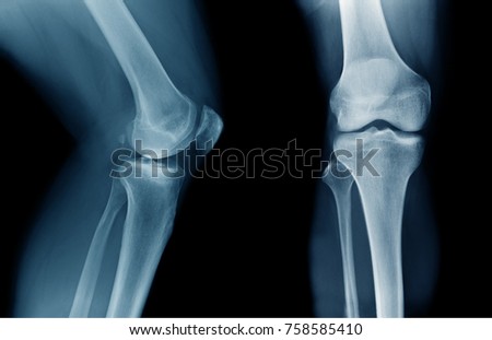 xray knee joint good quality Royalty-Free Stock Photo #758585410