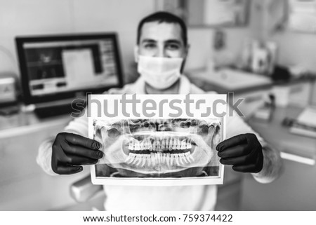 Doctor showing the x-ray of the patient in the dental clinic