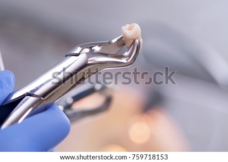 Dental equipment holding an extracted tooth Royalty-Free Stock Photo #759718153