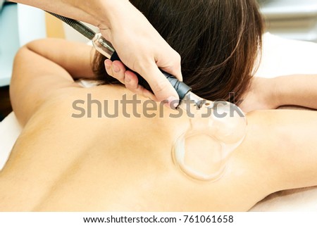 Vacuum massage. Medical procedure. Professional doctor.
