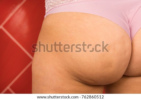 Cellulite on the butt of a fat woman.