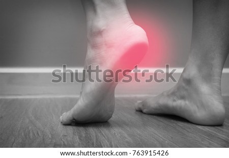 Closeup of a female foot heel pain with red spot, plantar fasciitis Royalty-Free Stock Photo #763915426