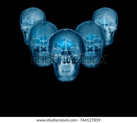 skull collection xray image