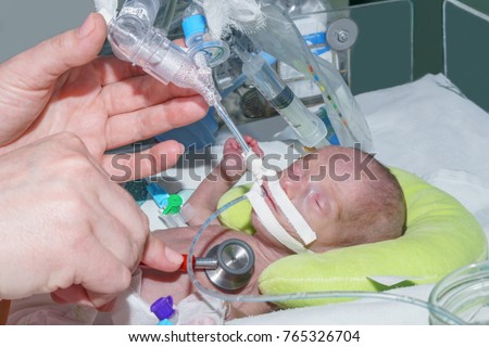 Doctor auscultate premature newborn on breathing machine with orogastric tube, peripheral intravenous catheter and pleural cavity drainage in neonatal intensive care unit Royalty-Free Stock Photo #765326704