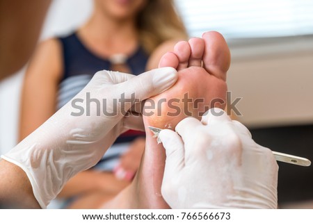 Chiropodist removes skin on a wart with a scalpel on the sole of Foot of a woman Royalty-Free Stock Photo #766566673