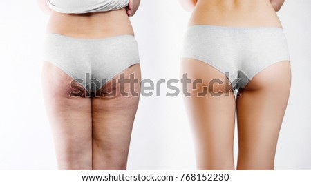 Female buttocks with cellulite before and after on a white background, retouch